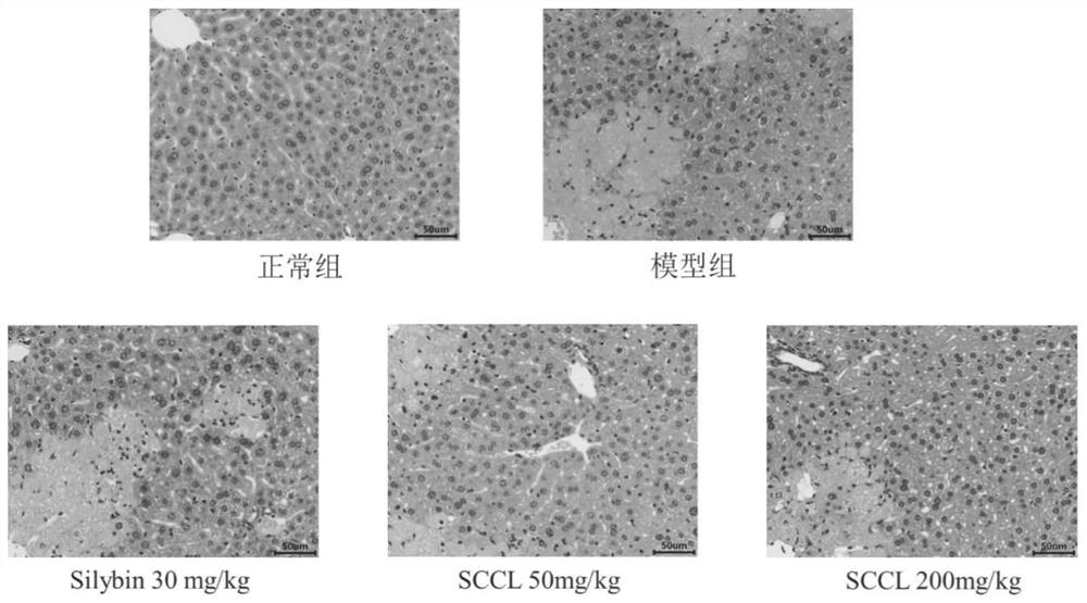 Application of sea cucumber cooking liquor dry powder in products for preventing and treating acute liver injury