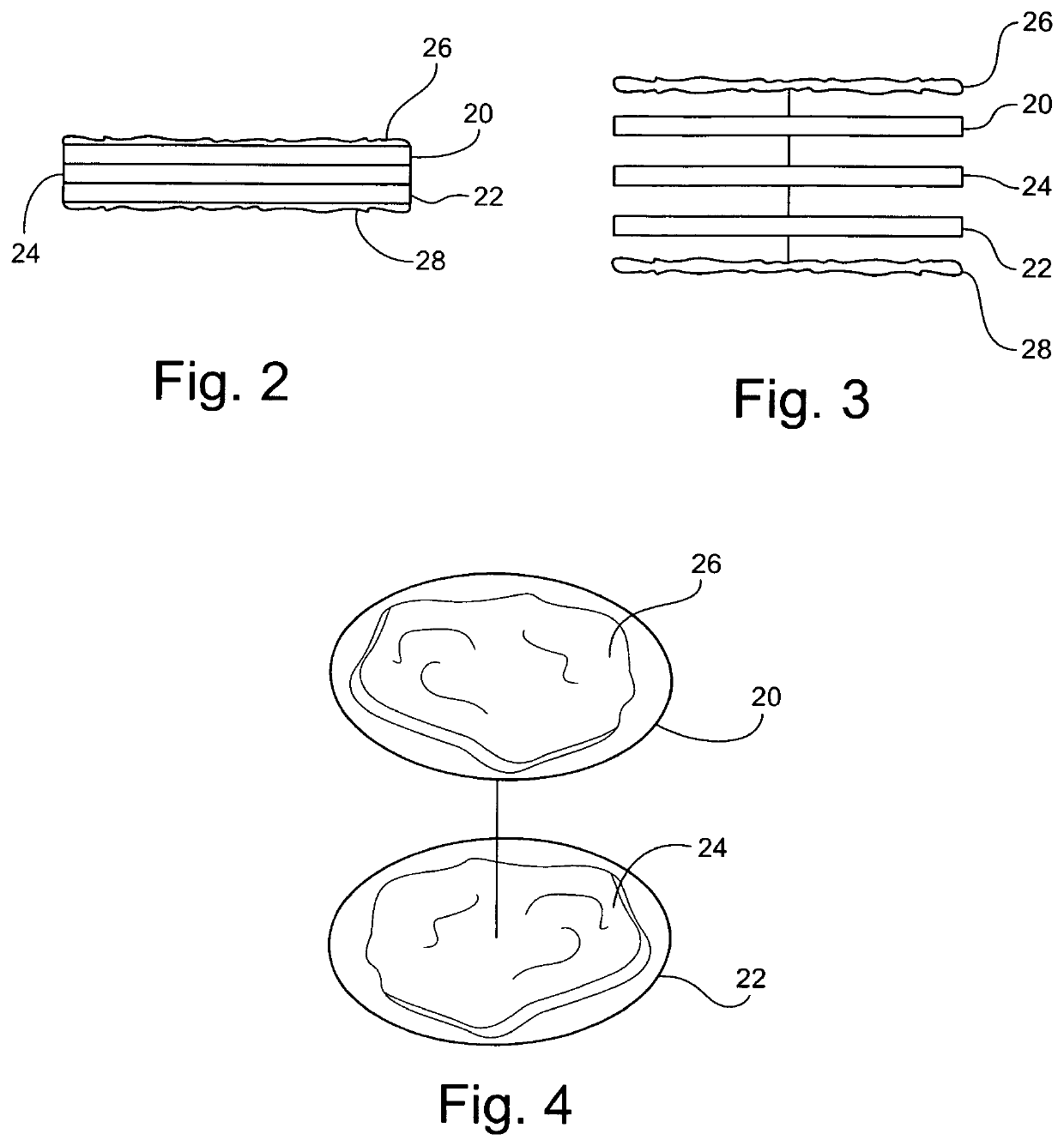 Prosthodontic tool and method for placing and fitting crowns and inlays