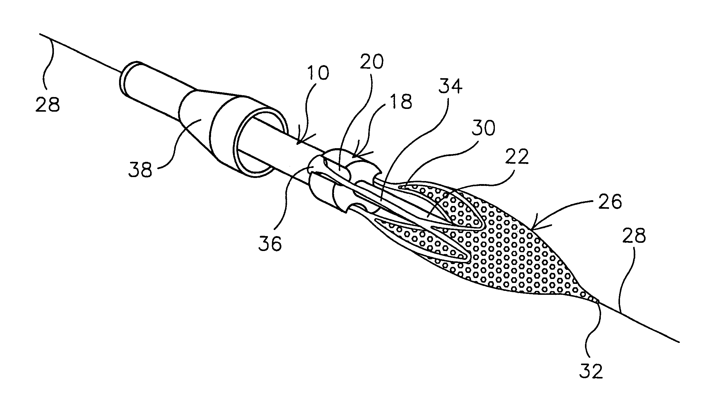 Distal protection mechanically attached filter cartridge