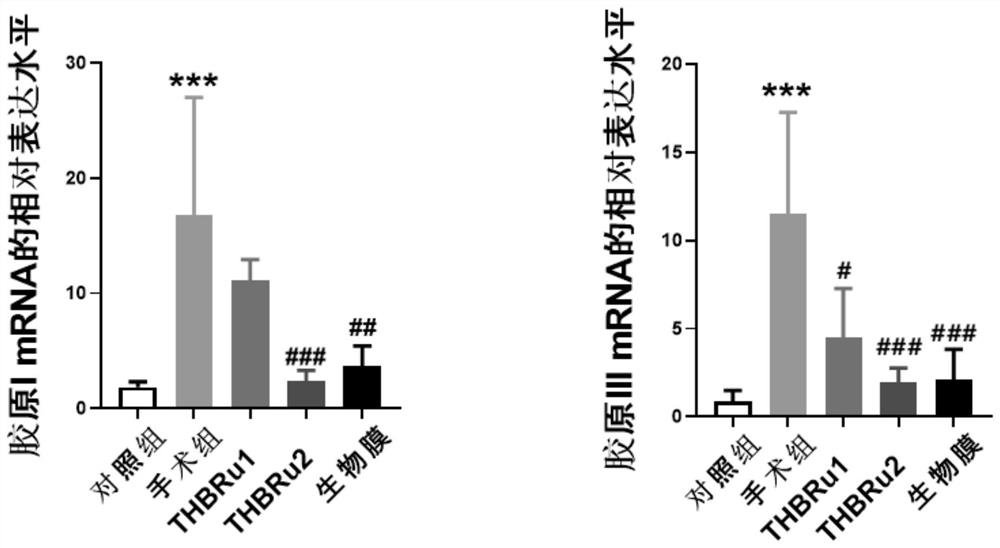 Application of tetrahydroberberrubine in preparation of medicine for preventing or treating intestinal adhesion diseases