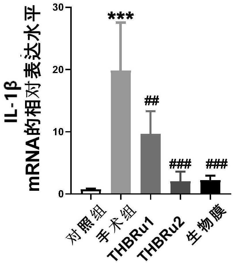 Application of tetrahydroberberrubine in preparation of medicine for preventing or treating intestinal adhesion diseases