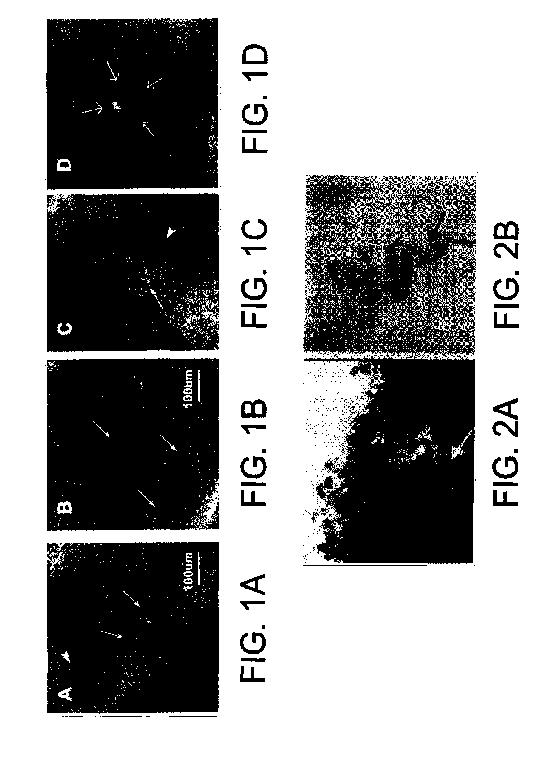 Non-invasive in-vivo imaging of mechanoreceptors in skin using confocal microscopy