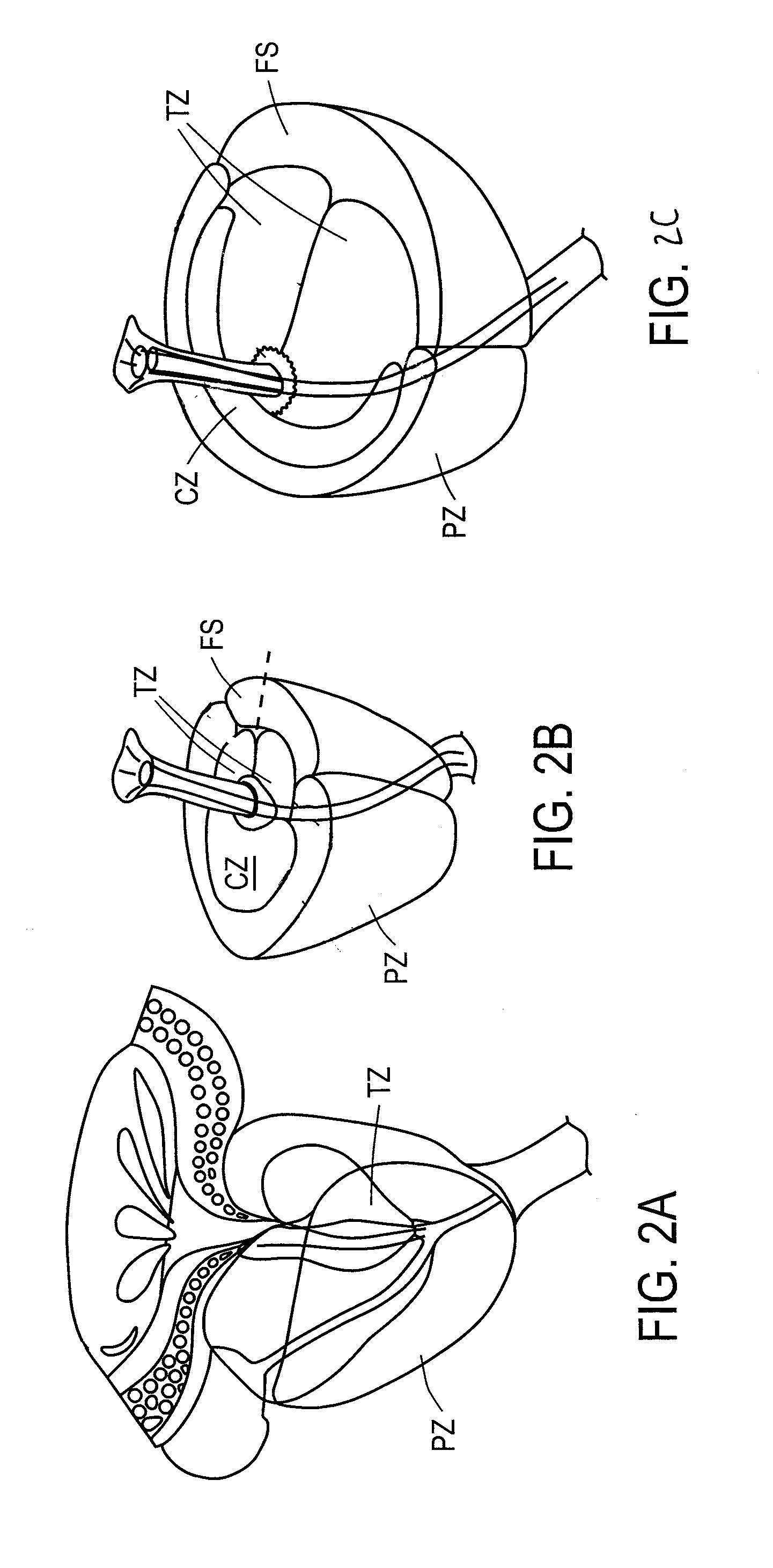 Systems and Methods for Prostate Treatment
