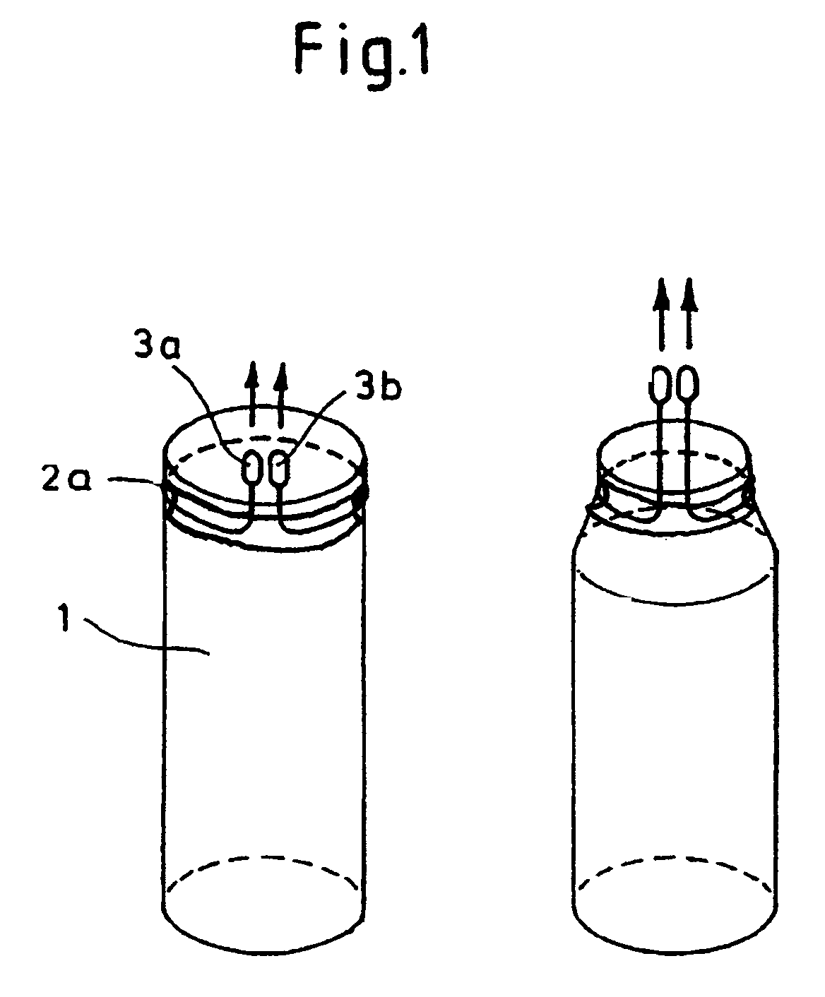 Removable essentially cylindrical implants