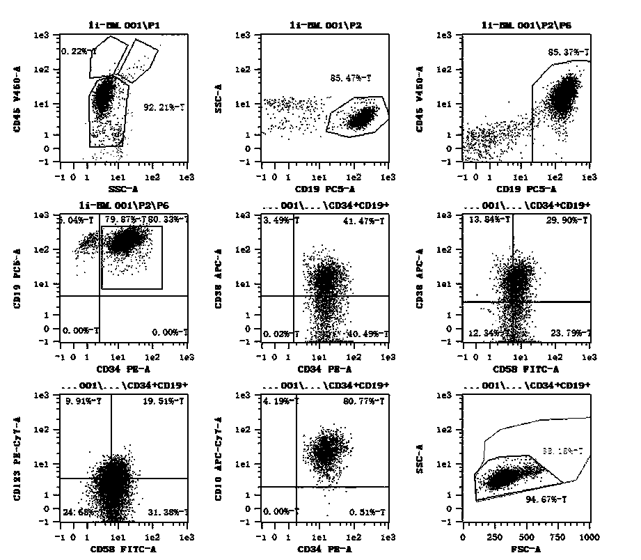 Method for constructing humanized Ph chromosome positive acute lymphocytic leukemia mouse model