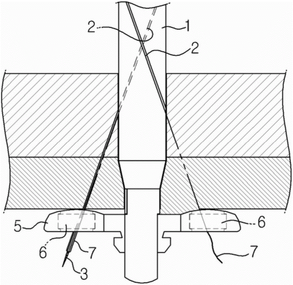 Laparoscopic port site closing apparatus