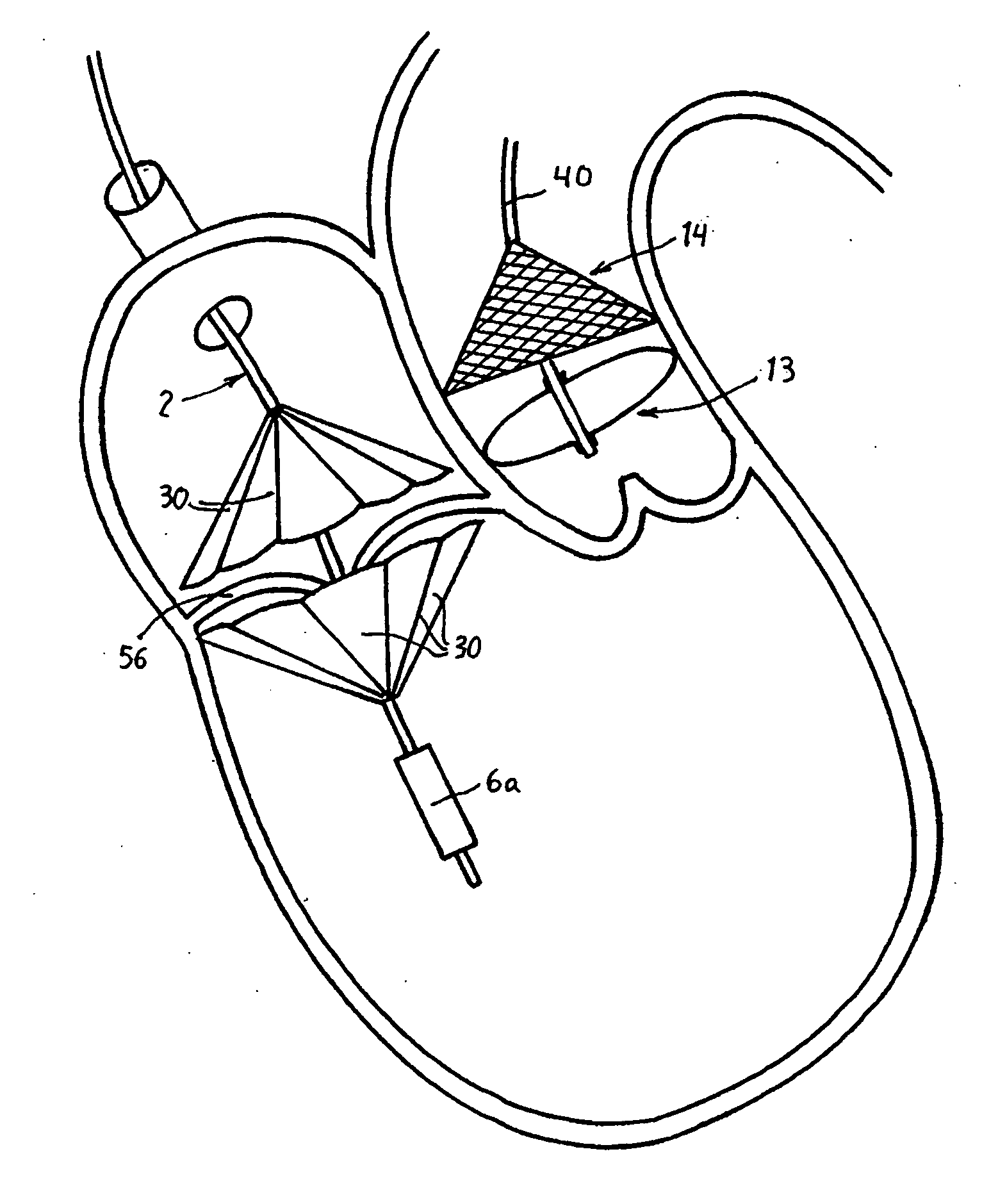 Prosthetic valve for transluminal delivery