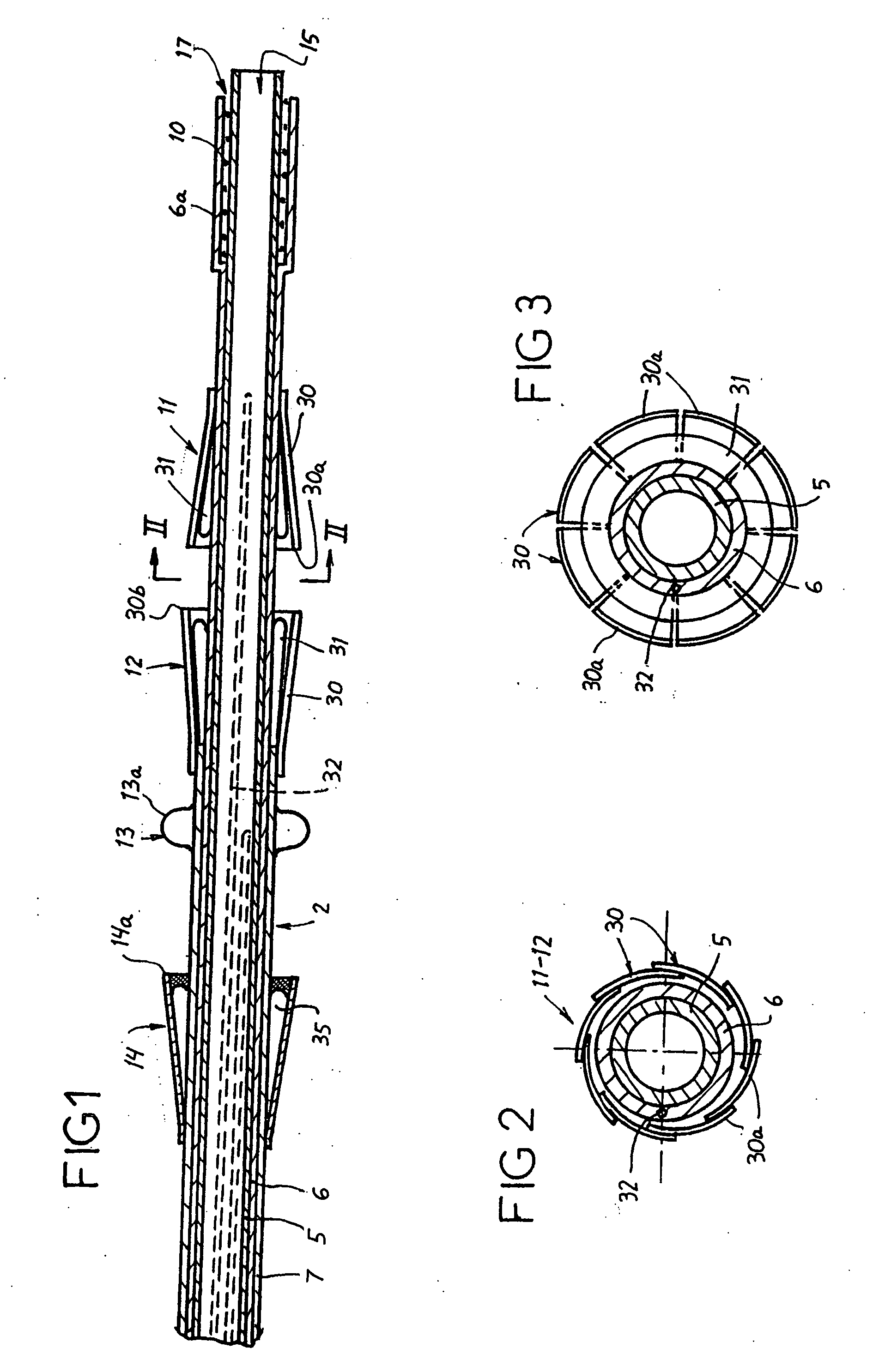 Prosthetic valve for transluminal delivery