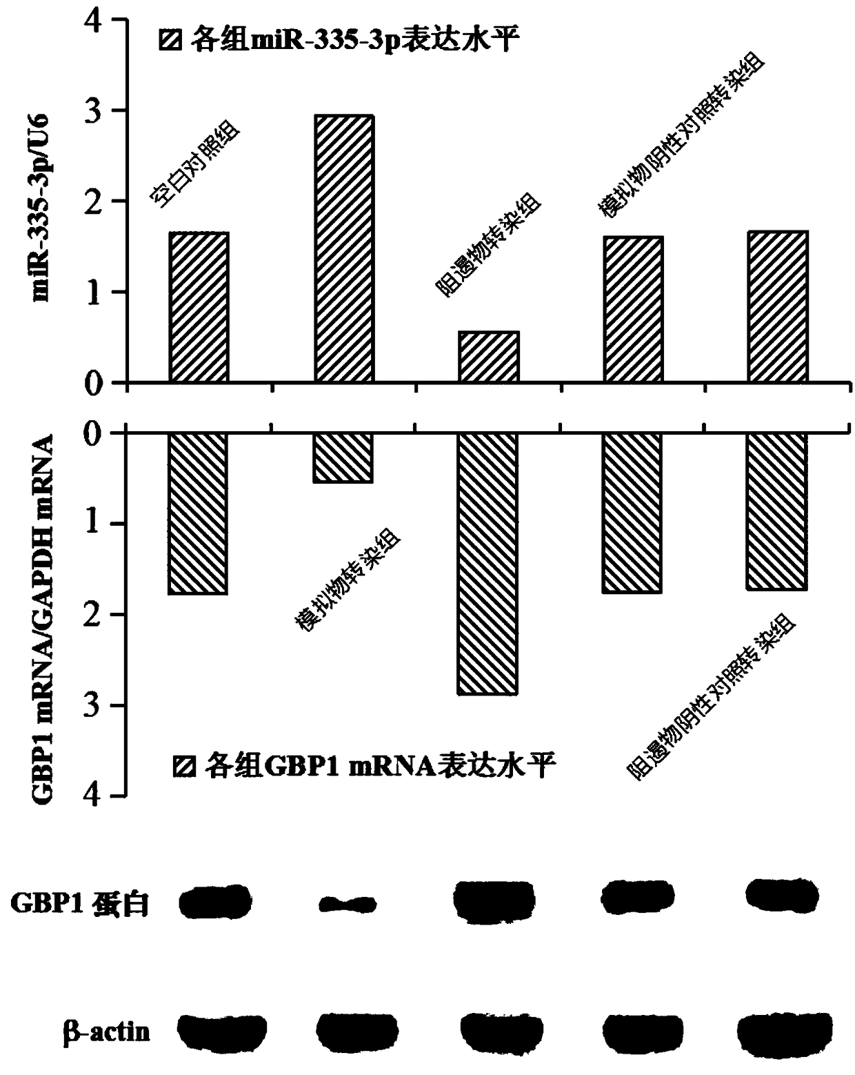 Application of gbp1 gene and its inhibitor in preparation of medicine for treating lung squamous cell carcinoma