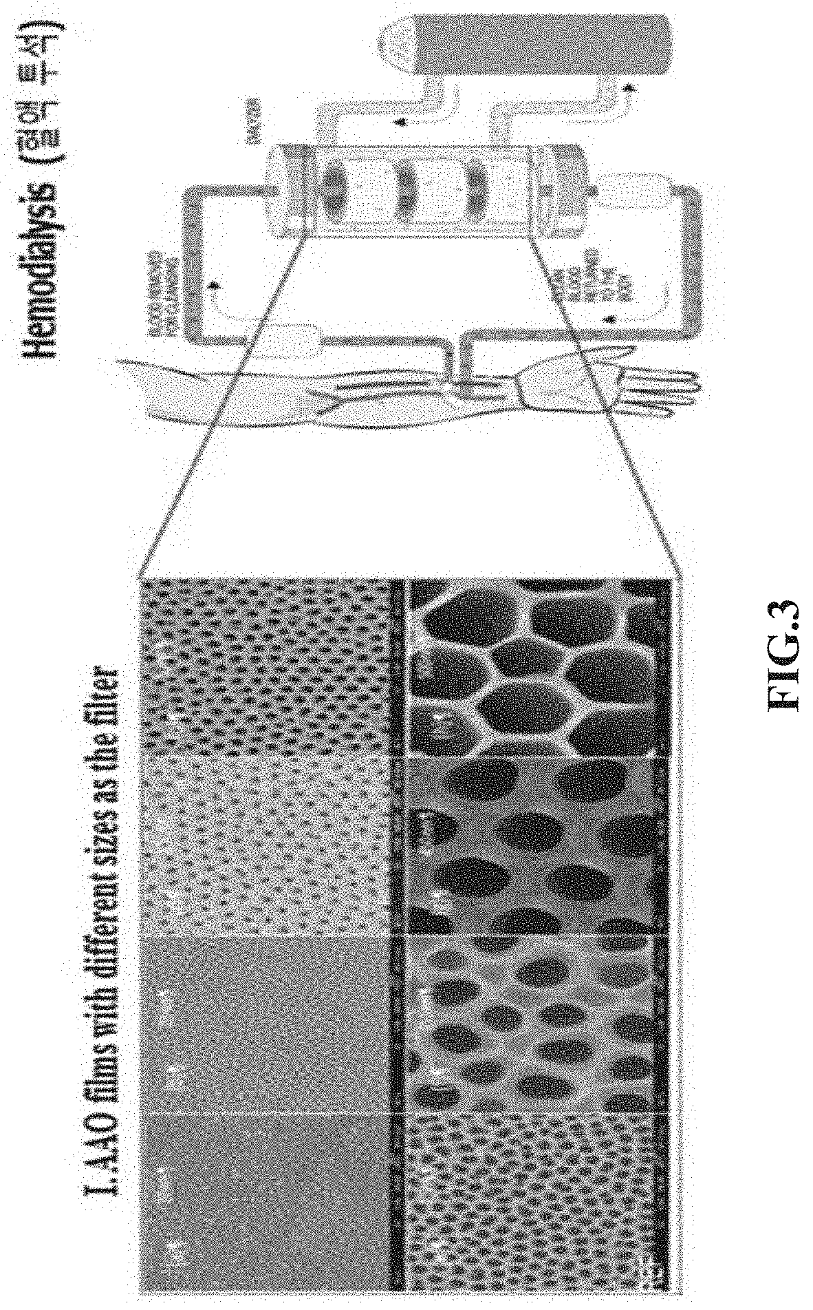 Apparatus and method for microwave therapy for blood cancer treatment