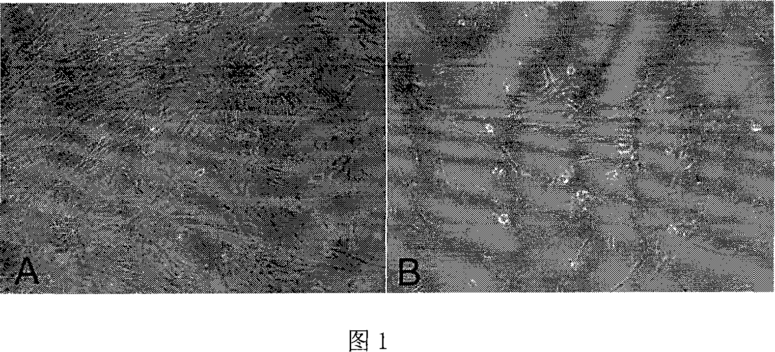 Artificial crystal with antiproliferous medicine coating for preventing and treating after-cataract forming
