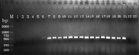 Rapid PCR (Polymerase Chain Reaction) testing method of silkworm densovirus BmDNV