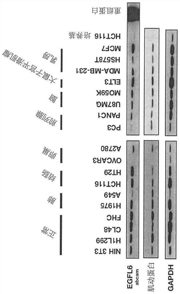 Anti-egf like domain multiple 6 (EGFL6) antibodies and their applications in cancer diagnosis and treatment