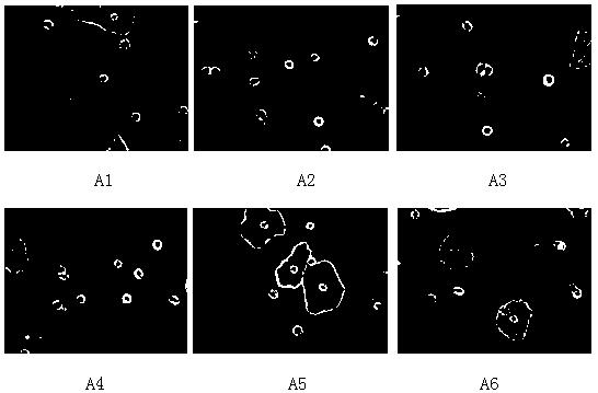 Automatic identification and statistics method for white blood cells in gynecologic microscopic image