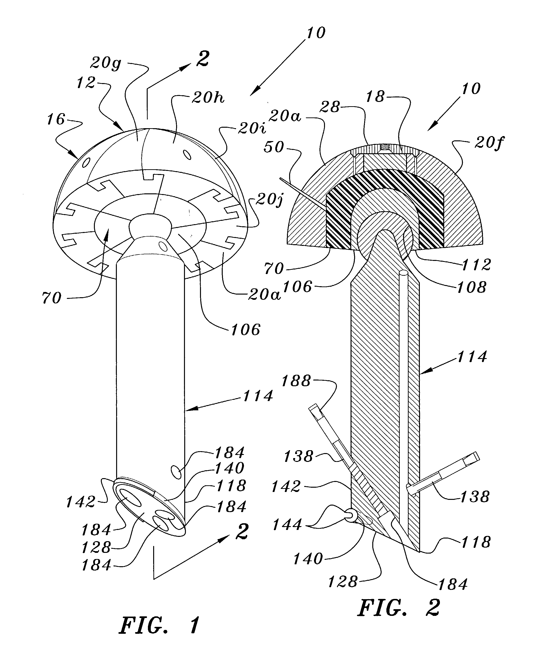 Joint prosthesis and method for implantation