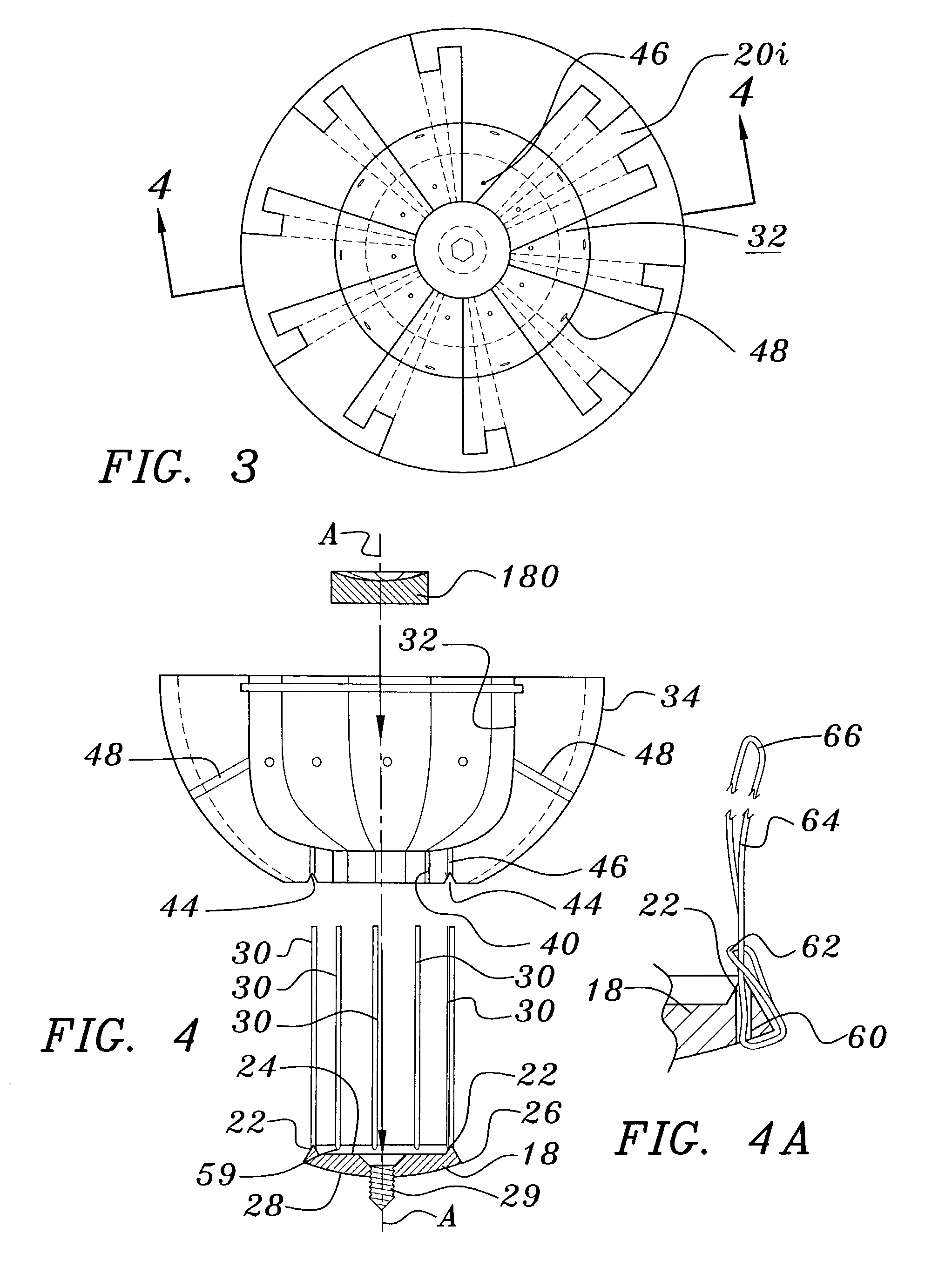 Joint prosthesis and method for implantation