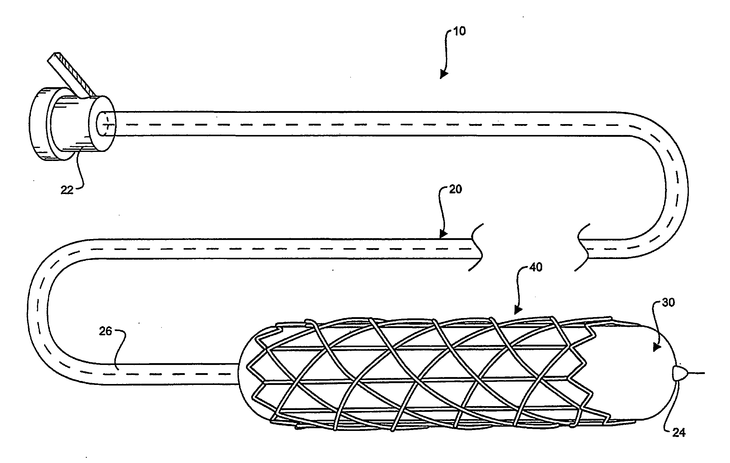 Hybrid Biodegradable/Non-Biodegradable Stent, Delivery System and Method of Treating a Vascular Condition
