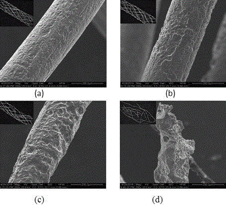 Woven fully-degradable magnesium alloy airway stent and preparation method thereof