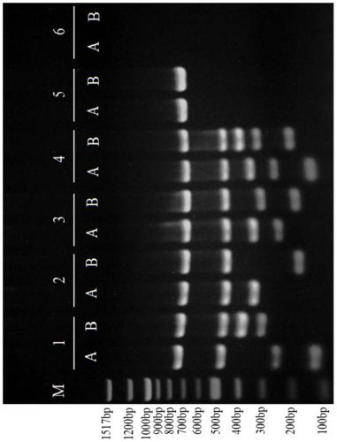 Amplification composition for Y chromosome microdeletion detection and kit thereof