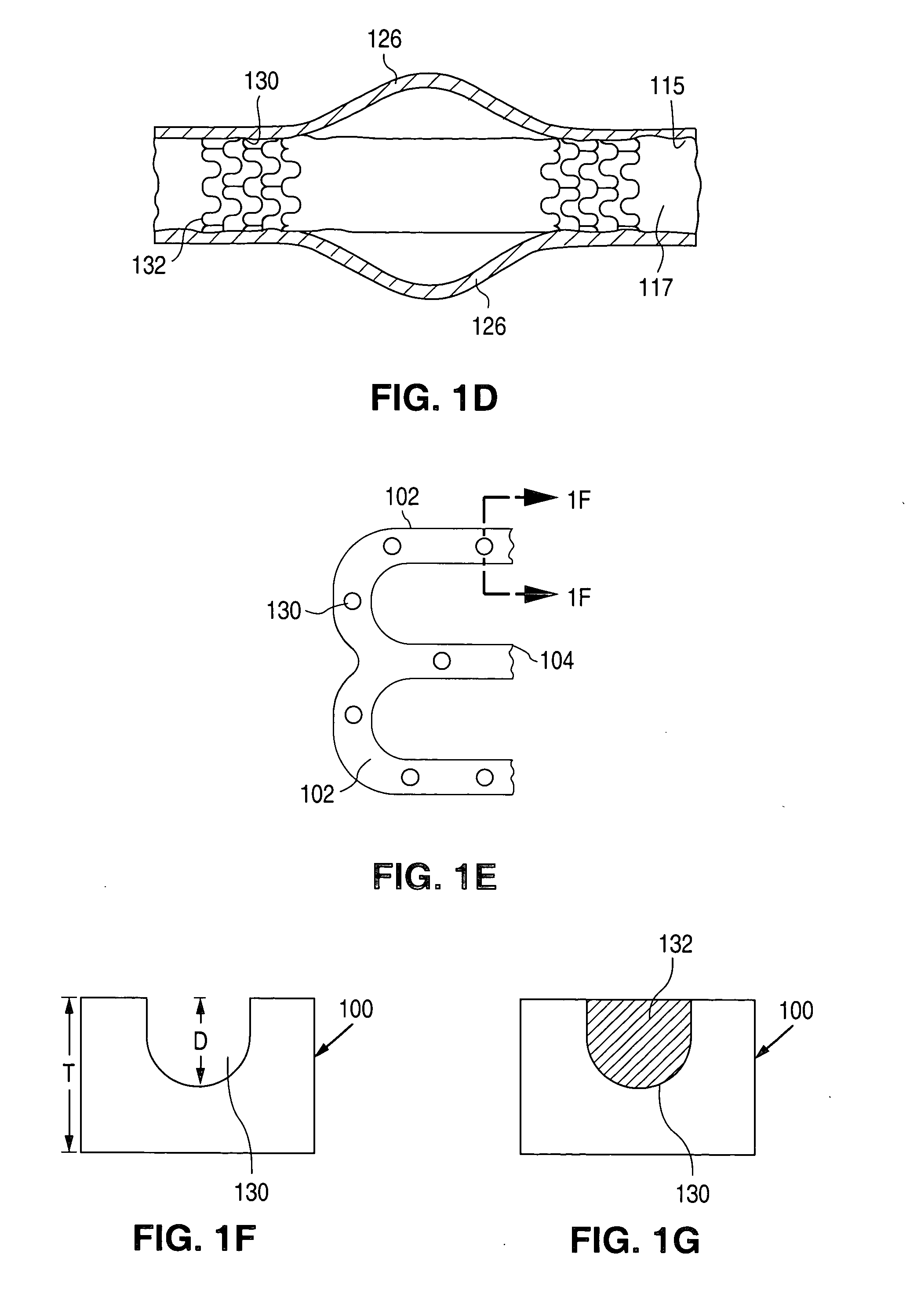 Method of making an implantable medical device