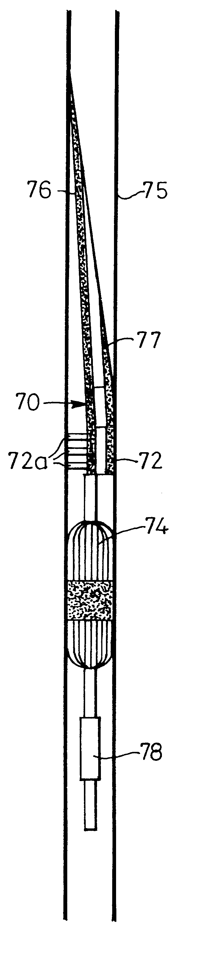 Wellbore primary barrier and related systems