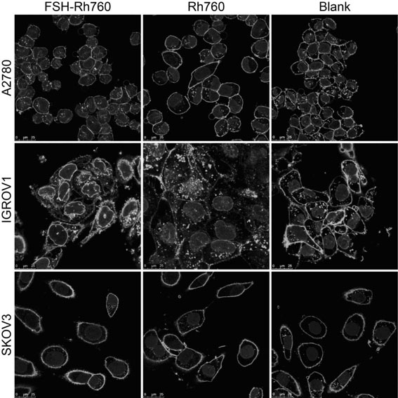 A tumor imaging and therapy probe targeting follicle-stimulating hormone receptor and its preparation method and application