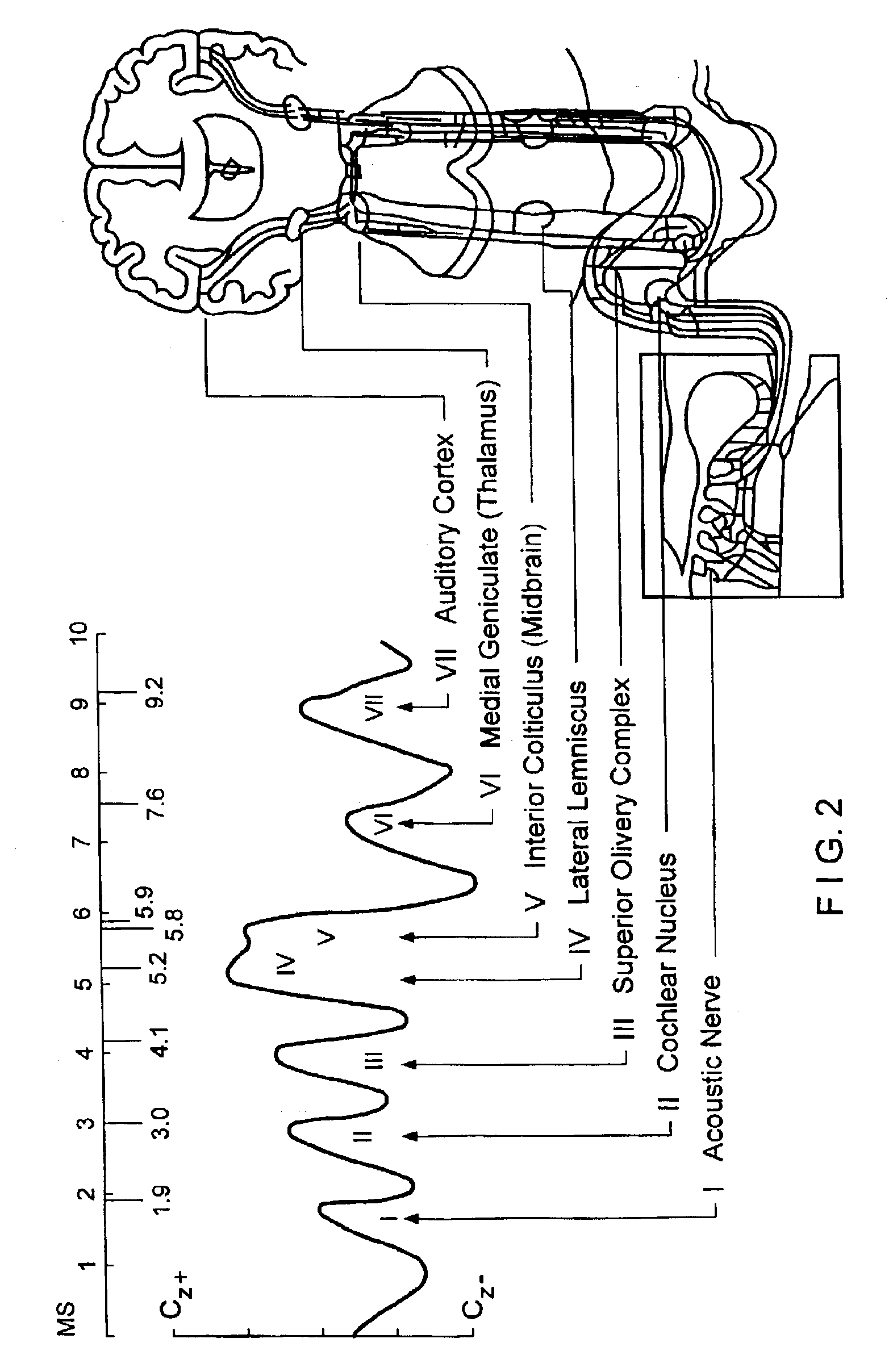 System and method for fetal brain monitoring