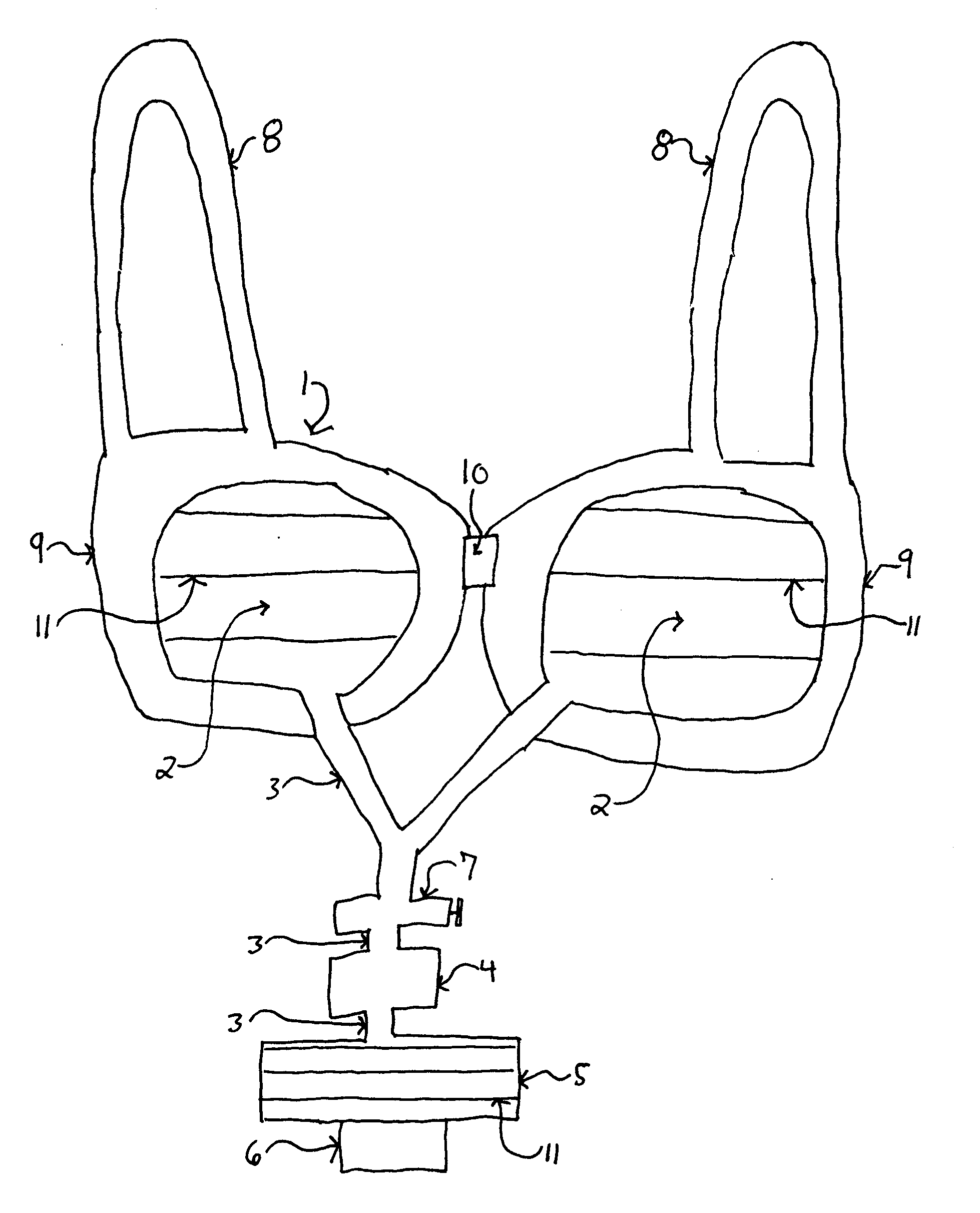Method and apparatus for preoperative estimation of breast implant volume