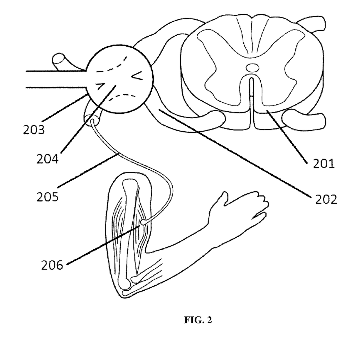 Systems and methods for pain treatment using spinal nerve magnetic stimulation