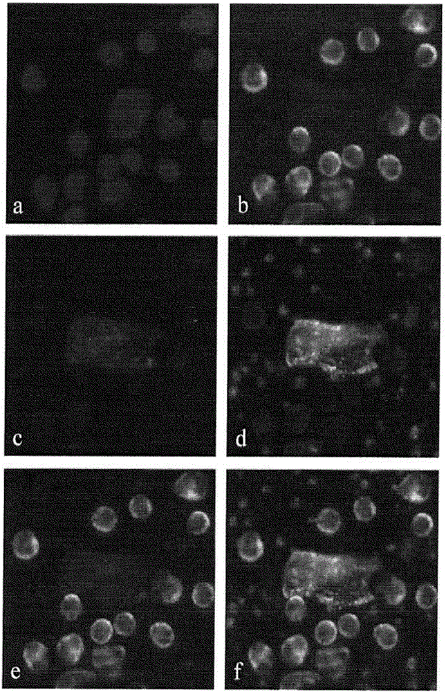 Methods for the detection and quantification of circulating endothelial cells