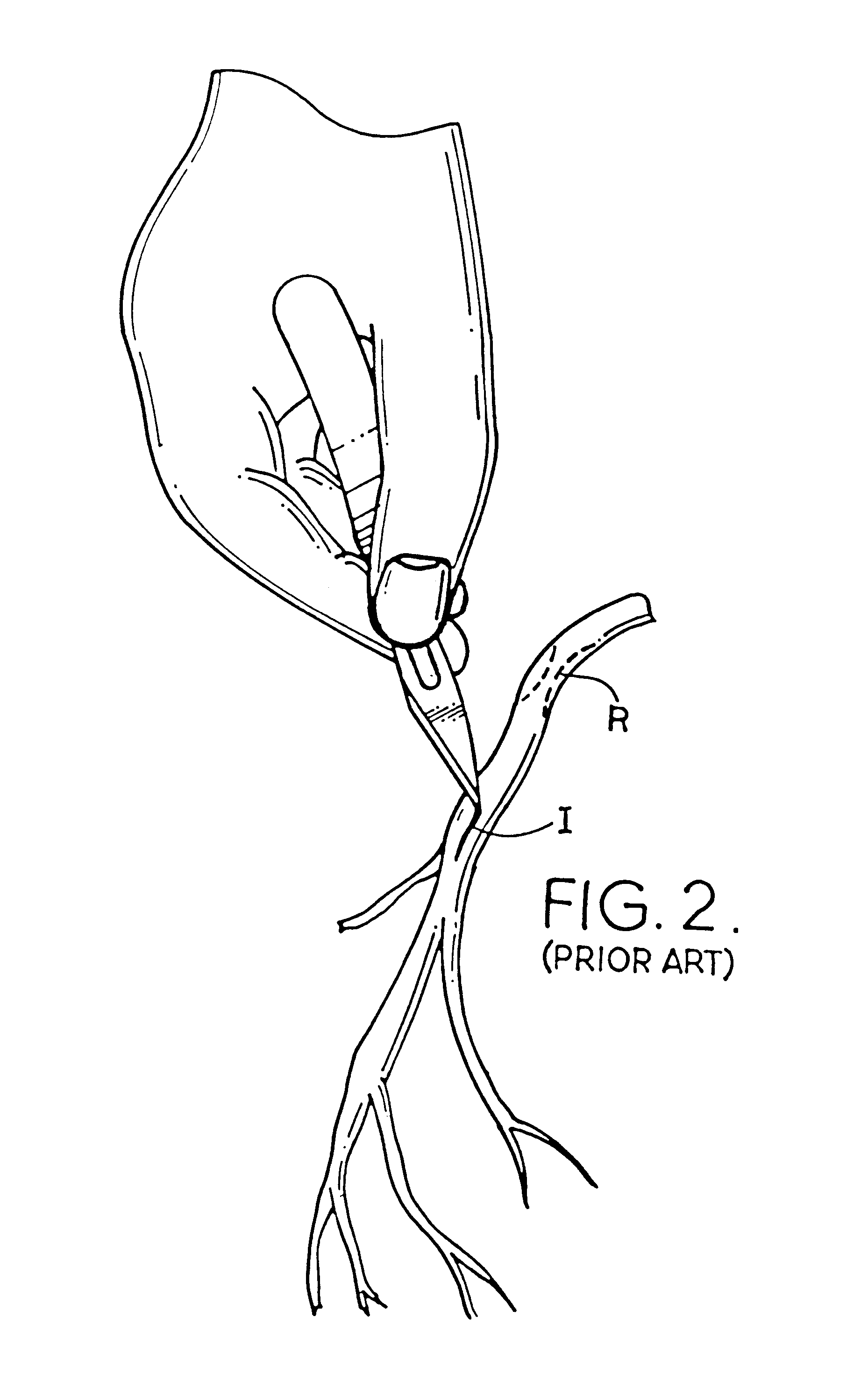 Apparatus and method for performing an anastomosis