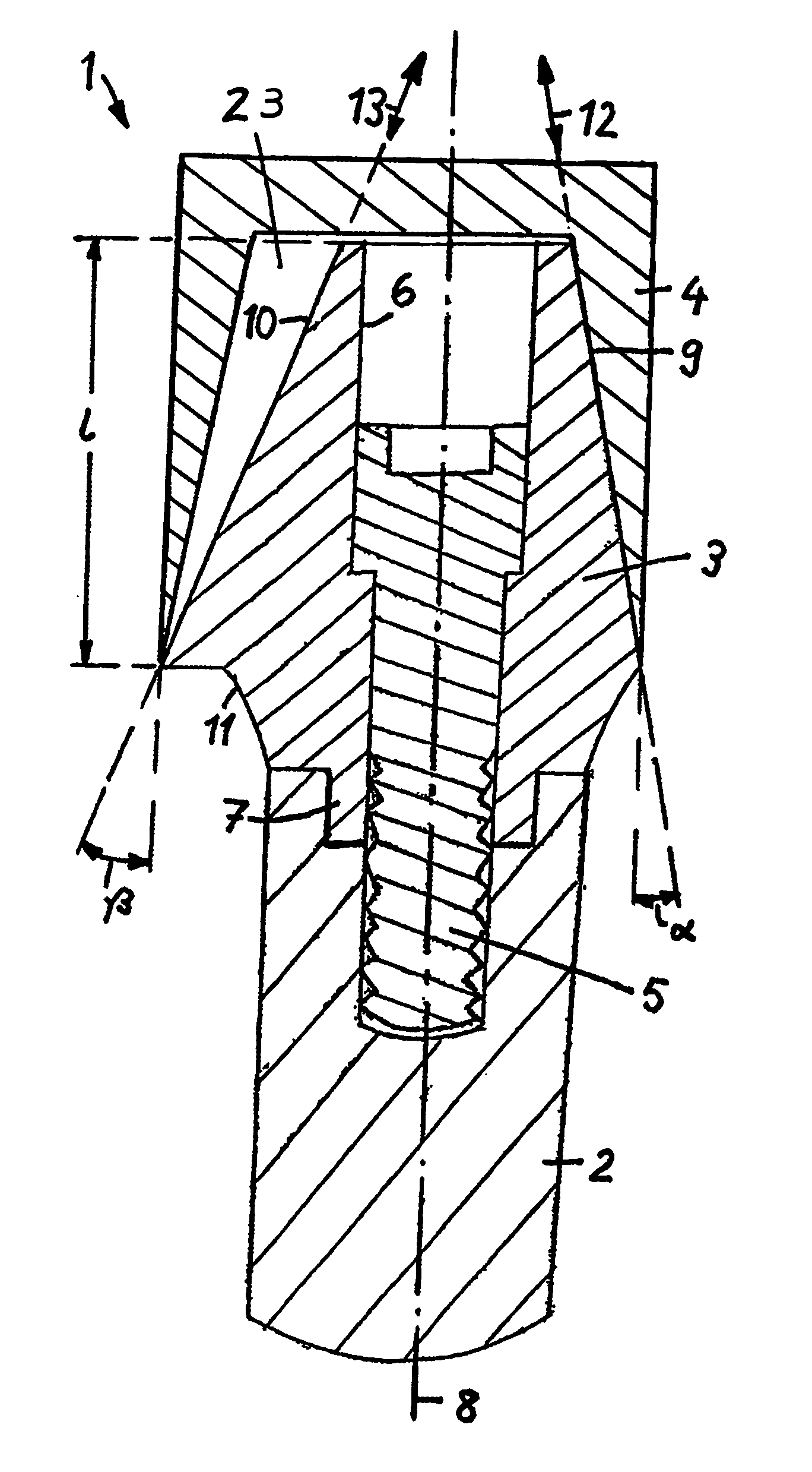 Tooth implant