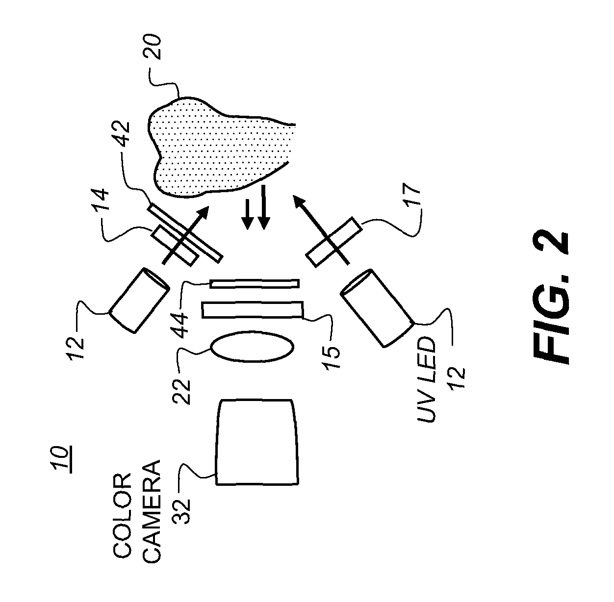 Method and apparatus for detection of caries