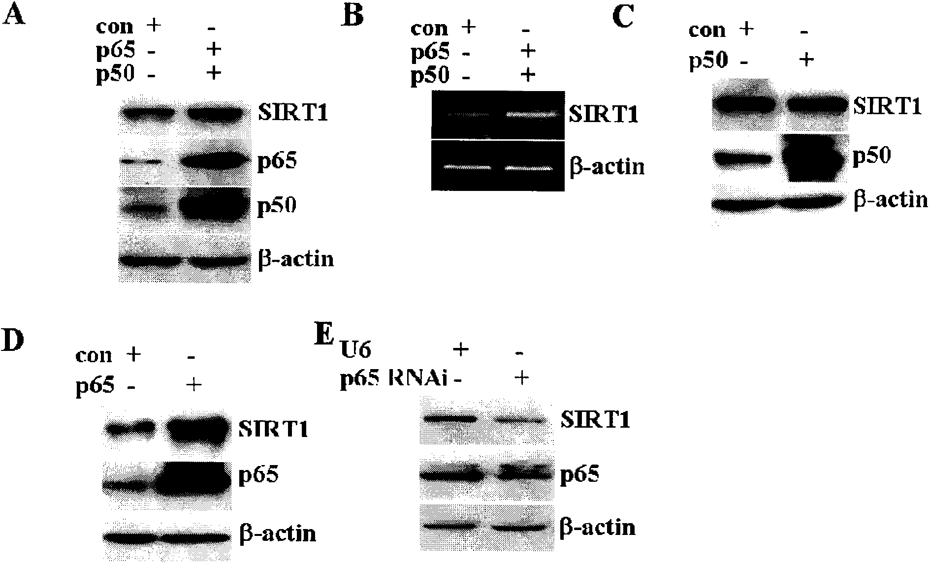 Application of p65 in preparation of medicament for up-regulating SIRT1 expression