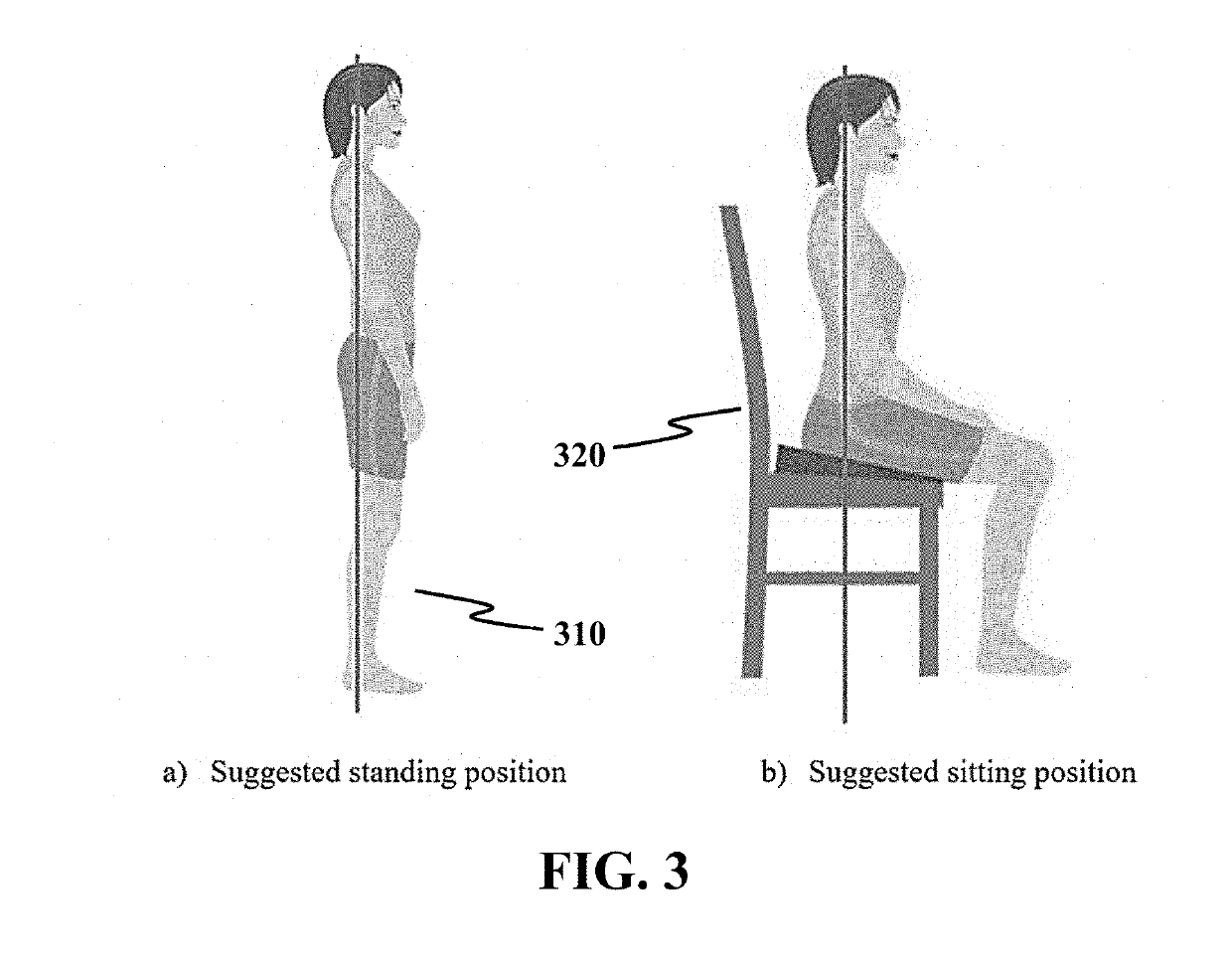 Biofeedback System with Body Mapping Clothing for Patients with Adolescent Idiopathic Scoliosis