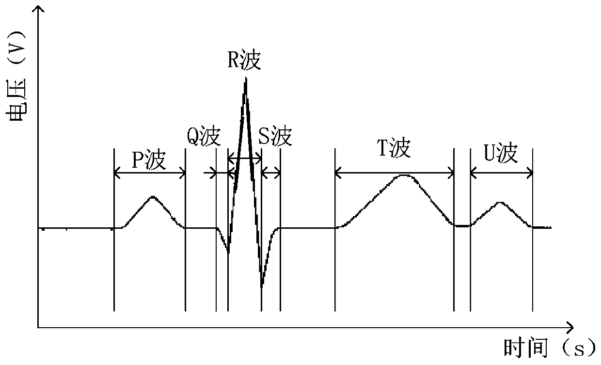 Electrocardiosignal classification method and device, electronic equipment and storage medium