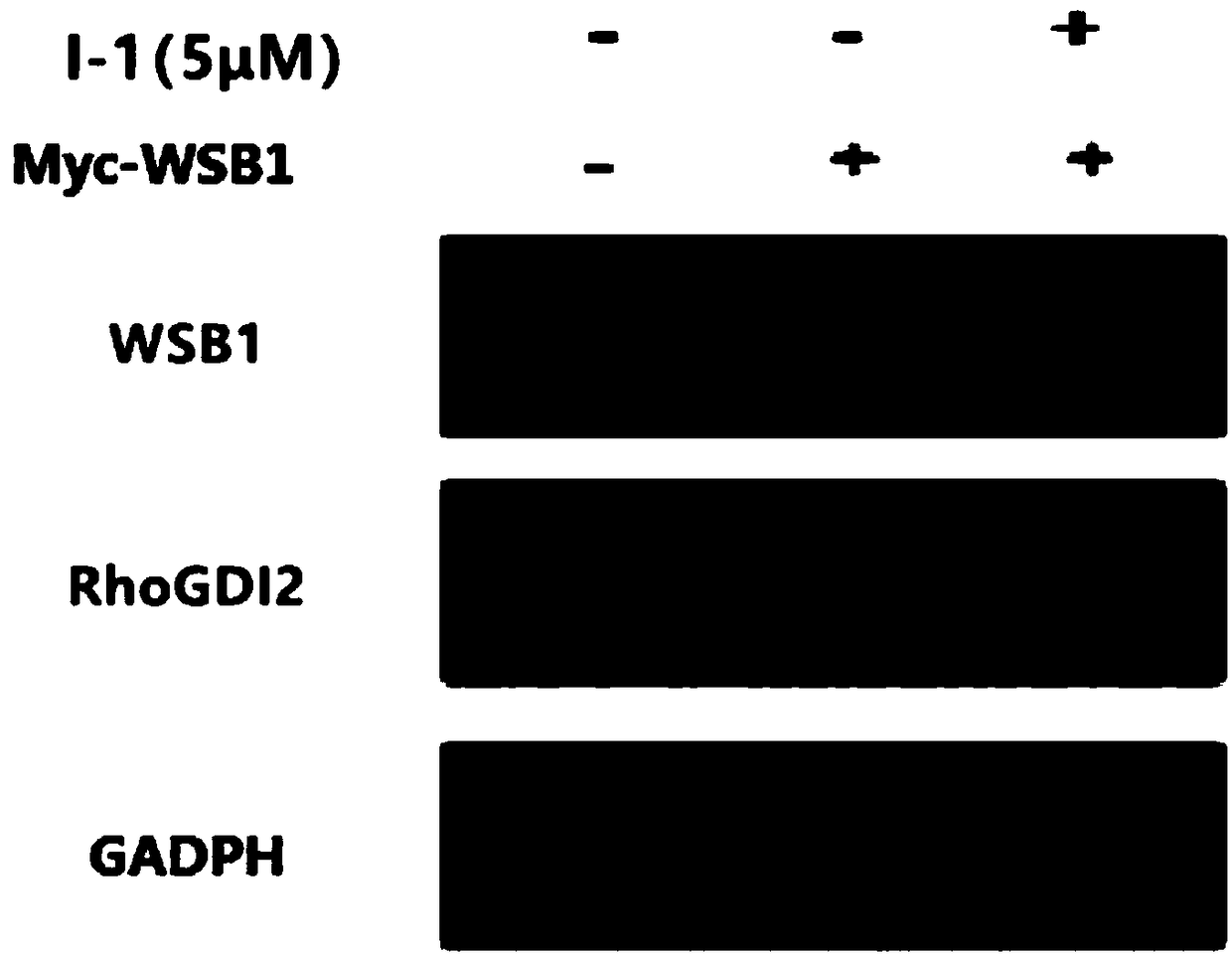 Polysubstituted 2-aminopyridine compound and application thereof in preparation of anti-tumor drugs