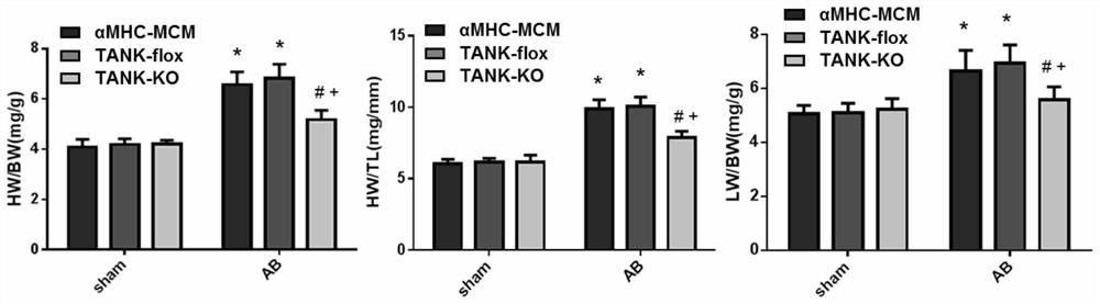 Application of traf-binding NF-κB activator (tank) and its inhibitors in the treatment of cardiac hypertrophy