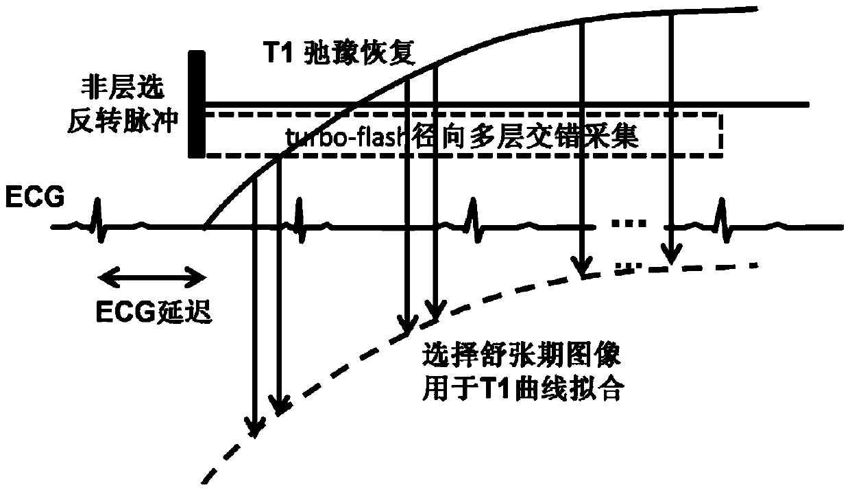 A method and device for quantifying myocardial T1