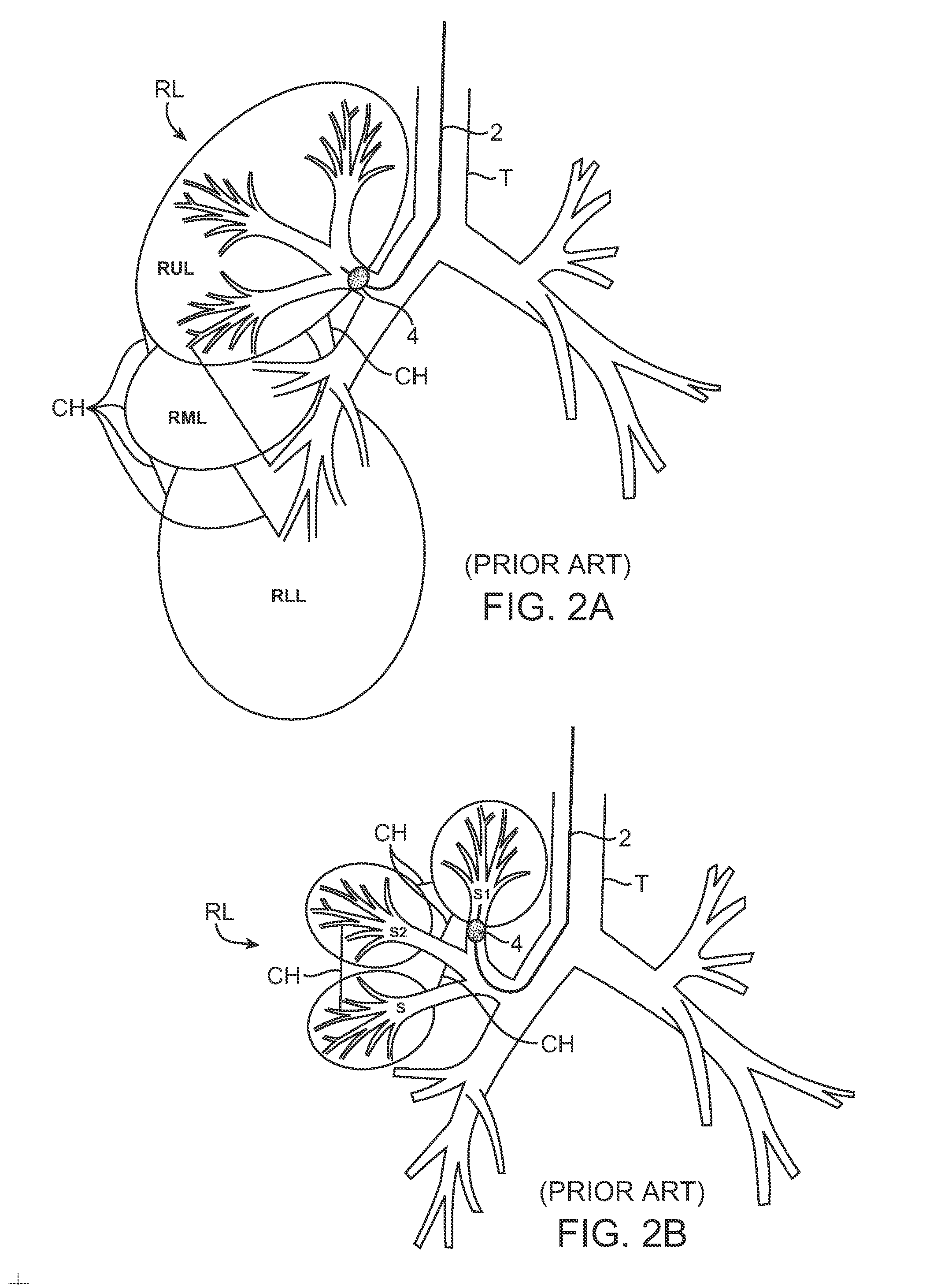 Methods and systems for segmental lung diagnostics