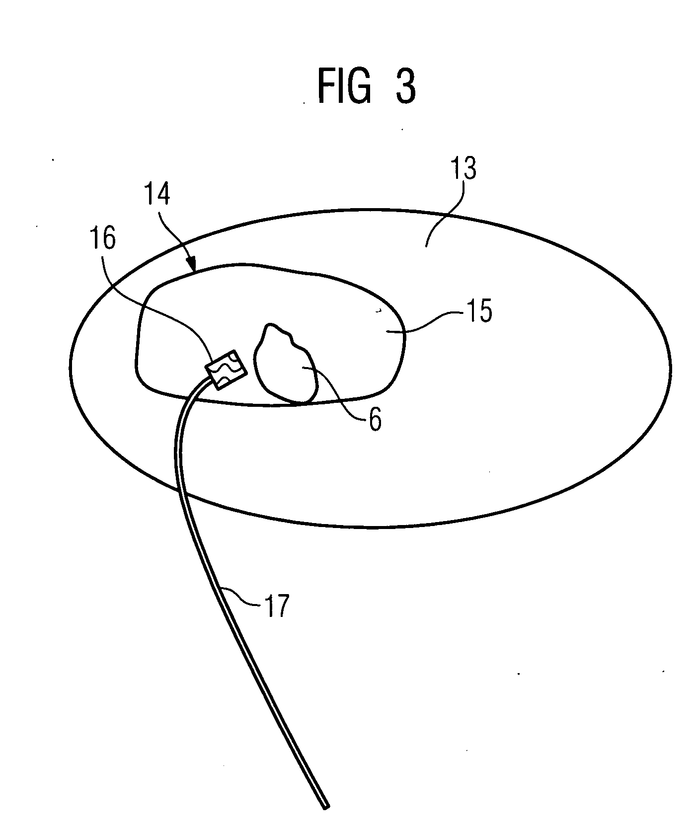 Method and device for examining a biological tissue