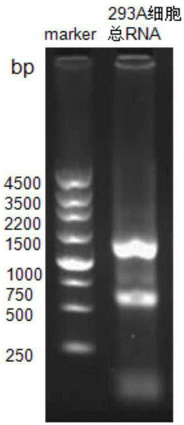 RT-PCR method for quantitatively detecting miRNA