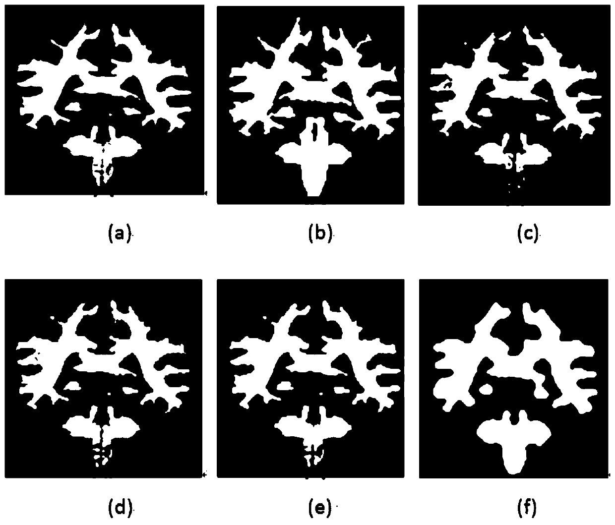 A Segmentation Method of Cranial Magnetic Resonance Image Based on Spatial Mixture Model