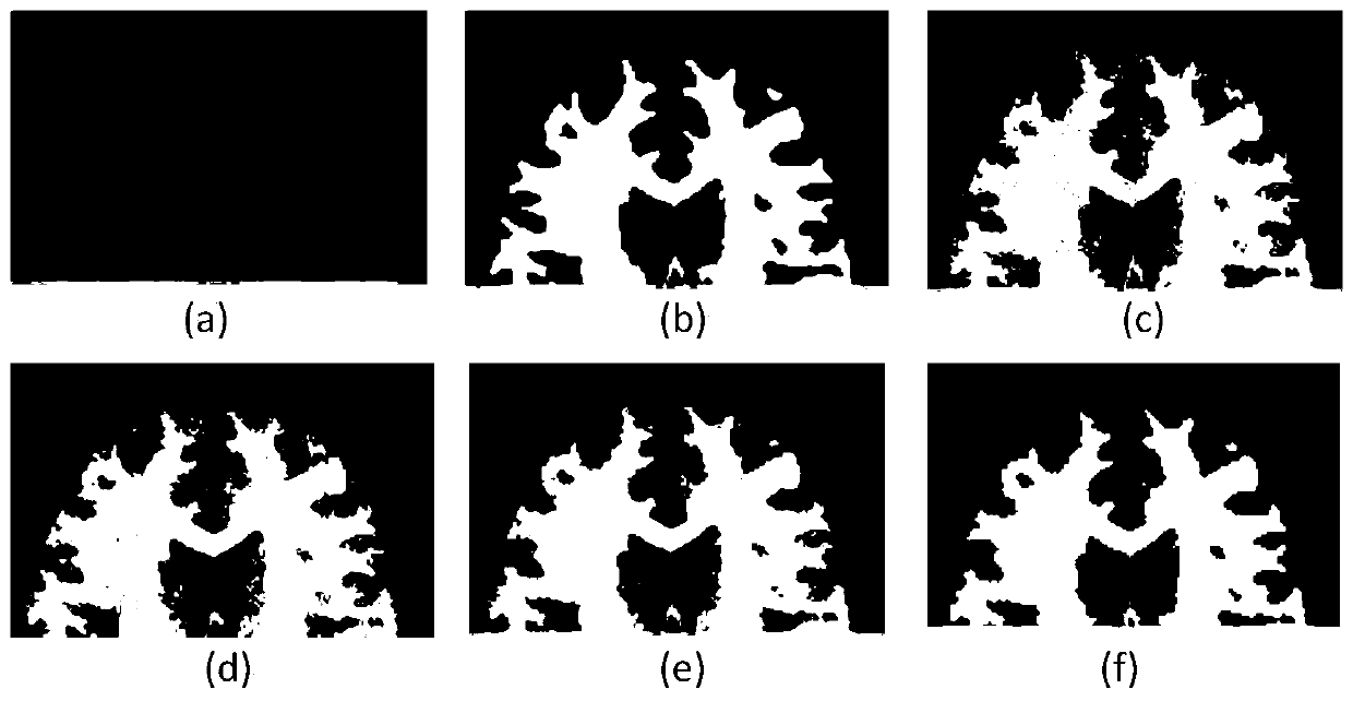 A Segmentation Method of Cranial Magnetic Resonance Image Based on Spatial Mixture Model