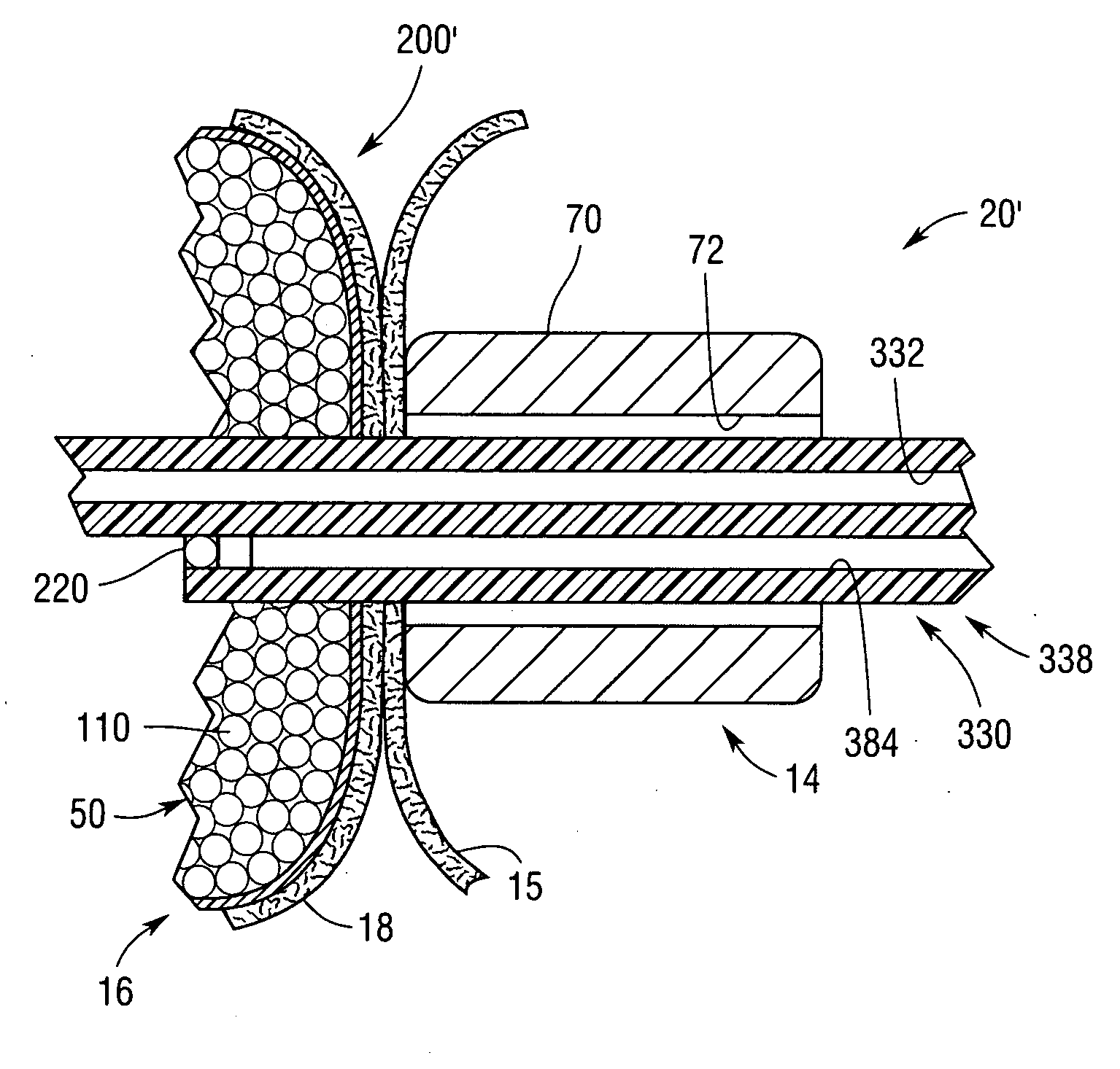 Surgical devices and methods using magnetic force to form an anastomosis