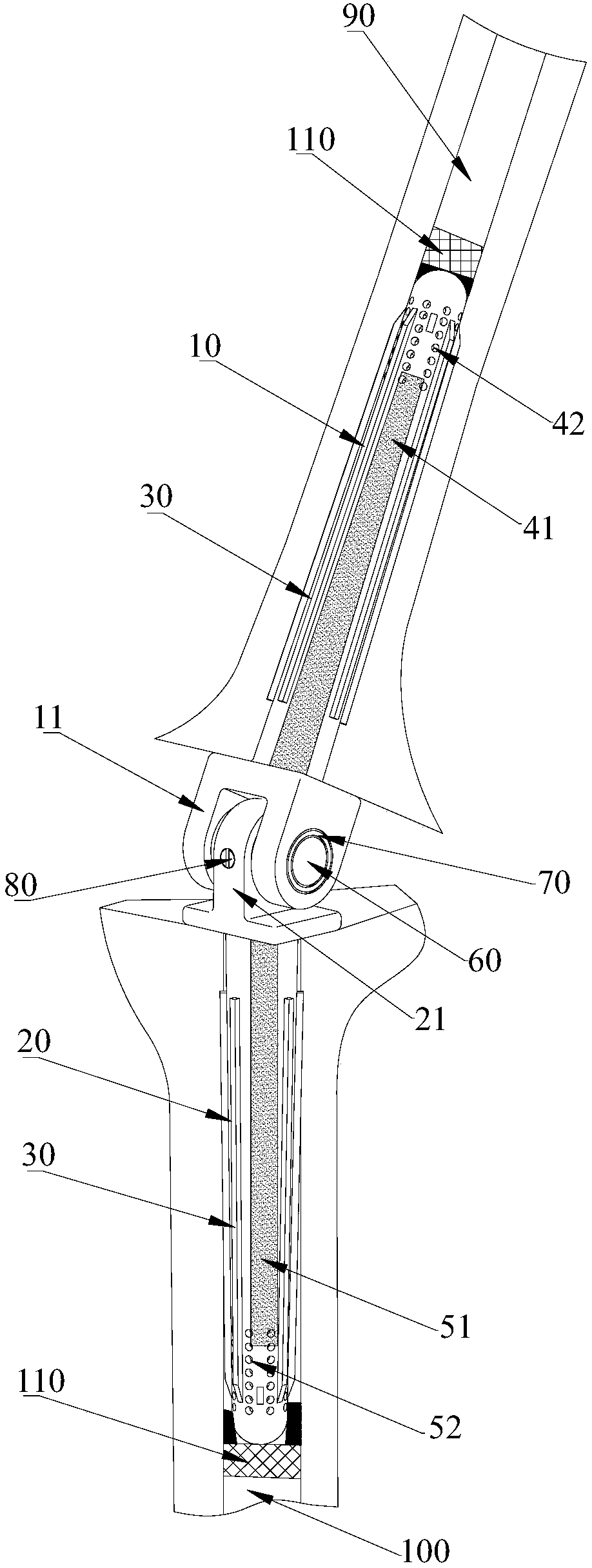 Elbow joint prosthesis