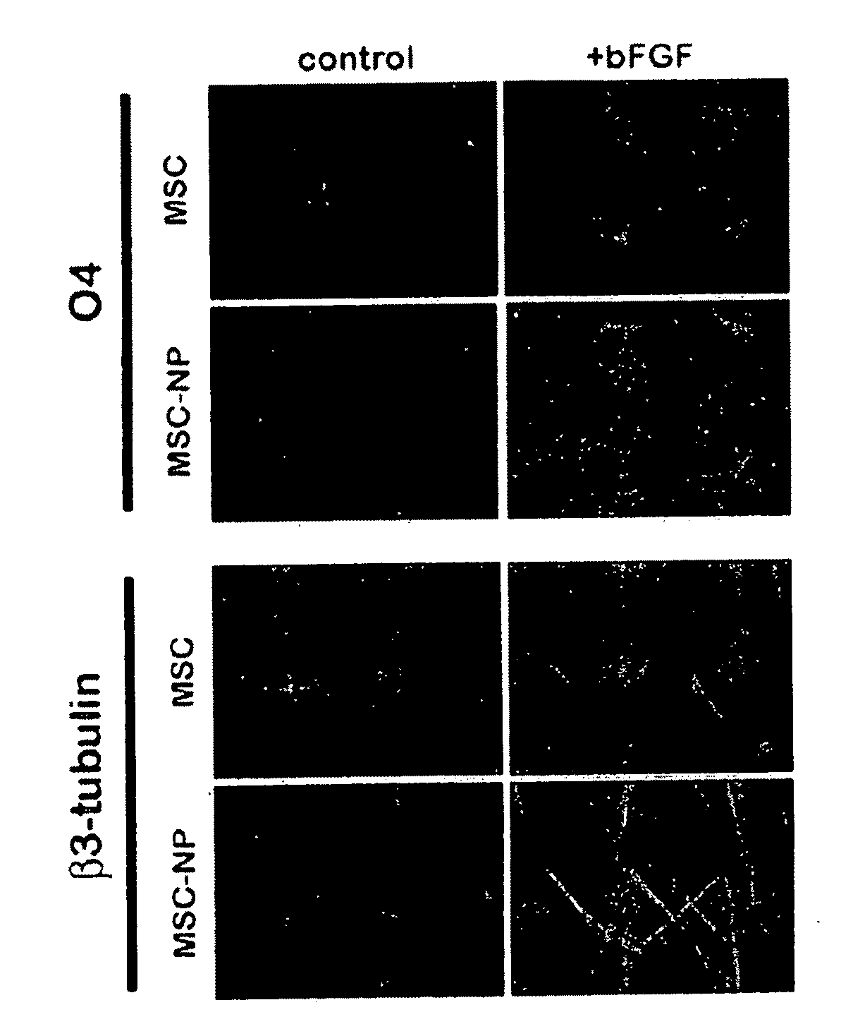 Bone marrow-derived mesenchymal stem cells as a source of neural progenitors