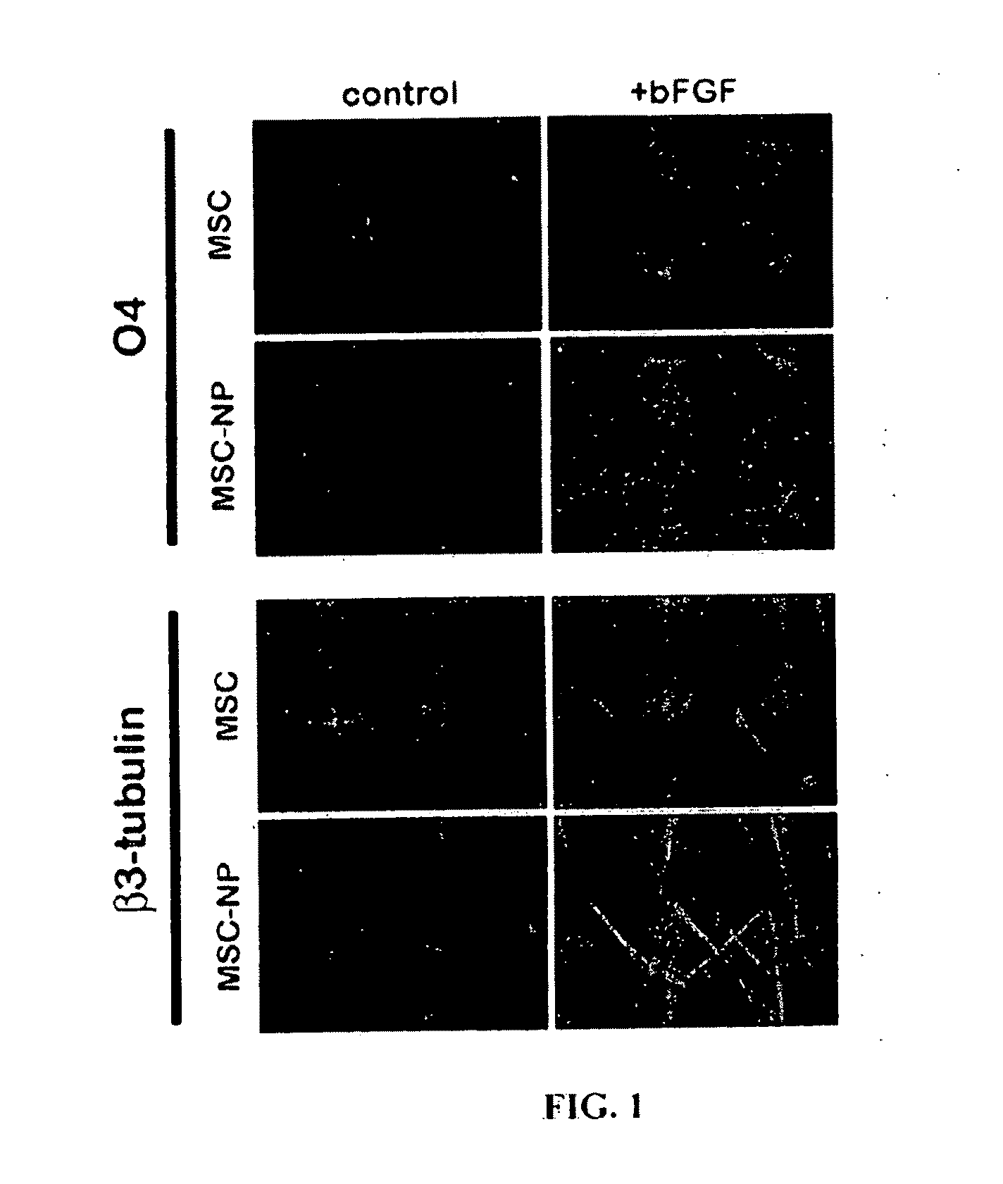 Bone marrow-derived mesenchymal stem cells as a source of neural progenitors