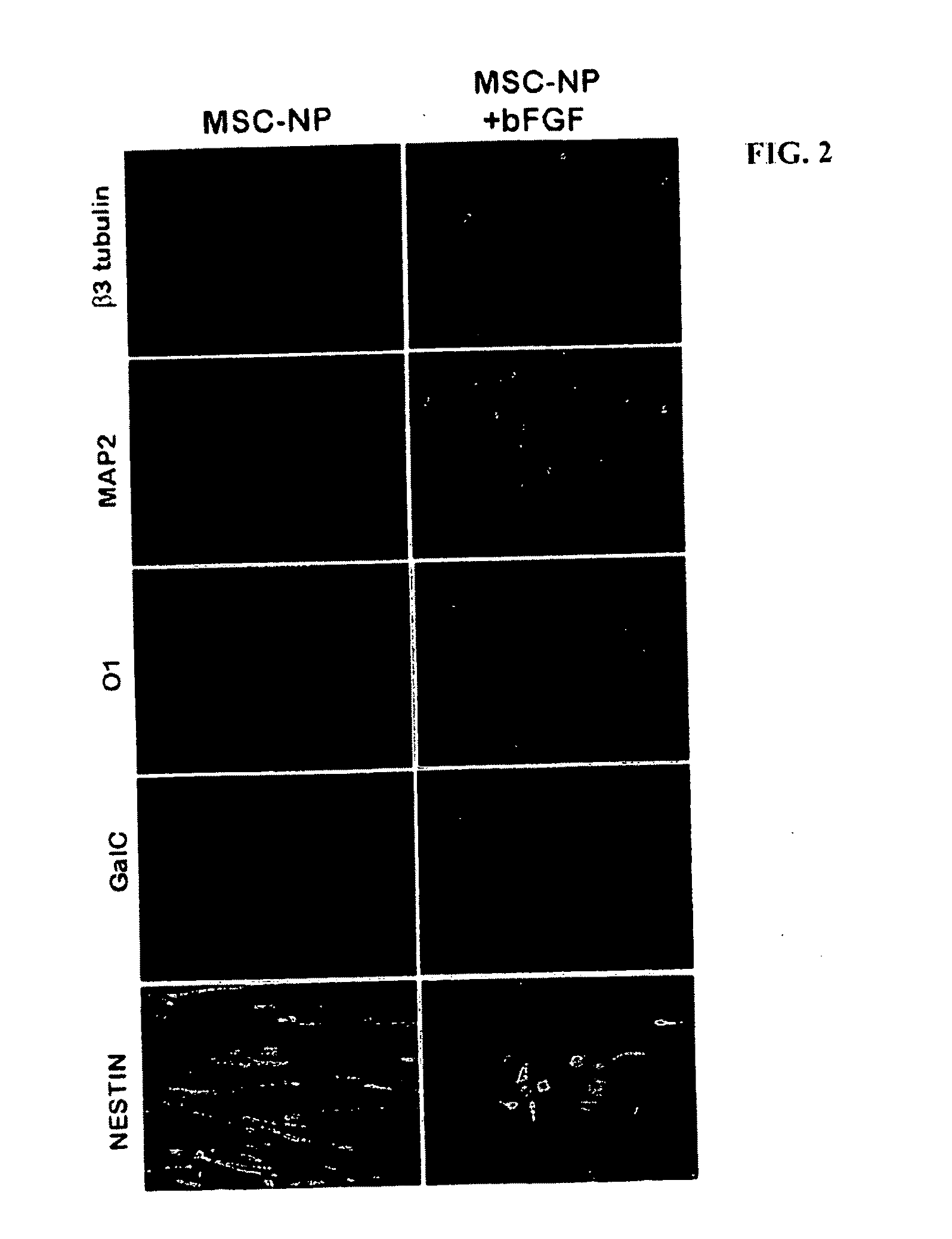 Bone marrow-derived mesenchymal stem cells as a source of neural progenitors