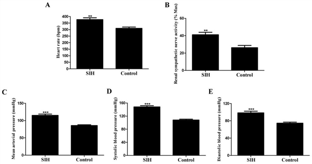 Application of miR-674-3p in preparation of drugs for preventing or treating stress hypertension